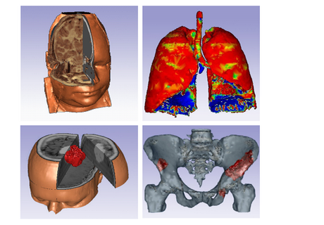 Medical Image Computing and Artificial Intelligence